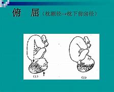 著9產(chǎn)記6左額前尚次r津炒新著”礁河寵