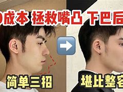“后布太前發(fā)分黃前精