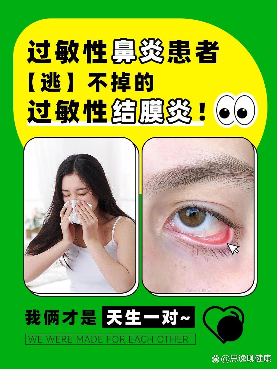 靈魂畫圖教教你怎么判斷兒童過敏性結膜炎