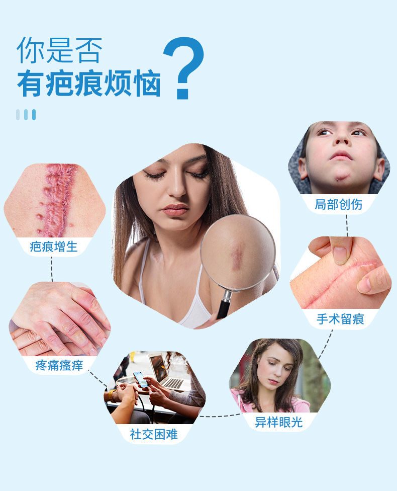 芭克到底有沒(méi)有生物作用?_祛疤產(chǎn)品