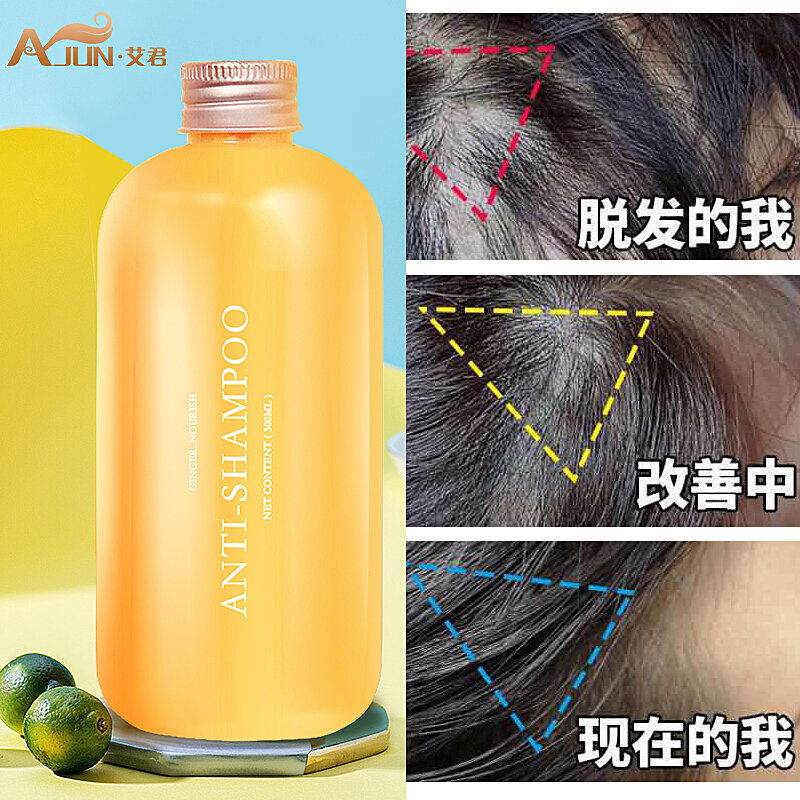 艾君生姜洗發(fā)水【報(bào)價(jià)價(jià)格評測怎么樣】